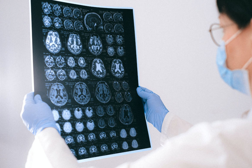 fisioterapia-neurologica