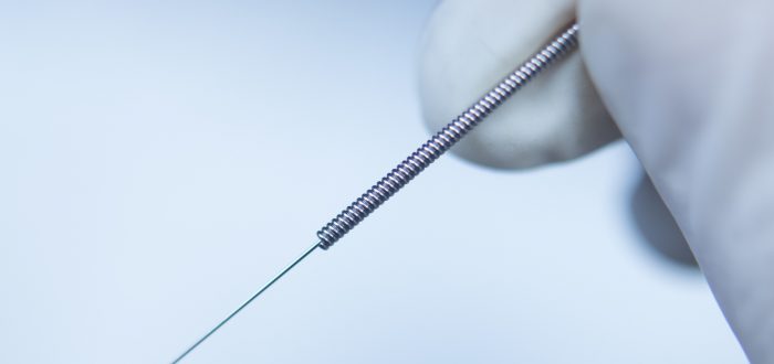 Acupuncture needle dry needling