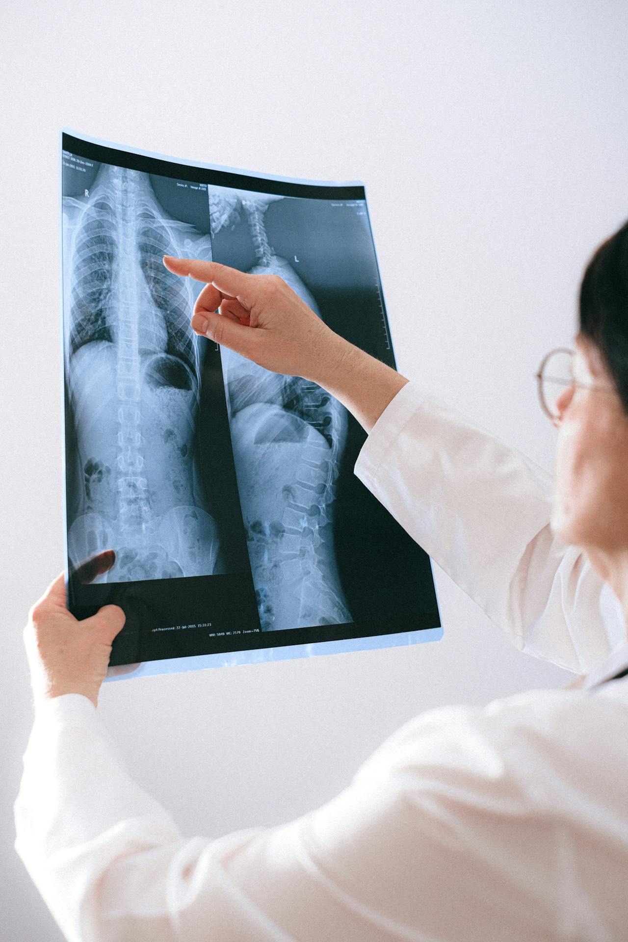 fisioterapia-respiracion