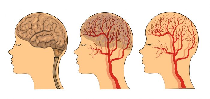 the brain , the vessels of the brain