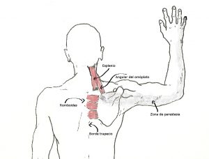Musculatura activadora de la escápula. 