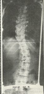 columna1