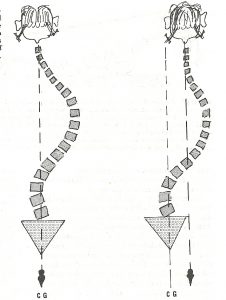 tipos de escoliosis