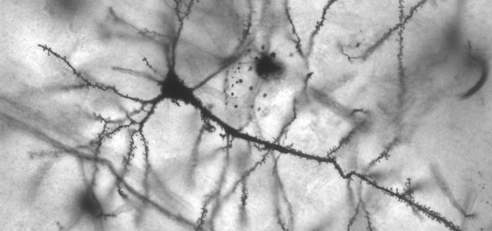 1008px-pyramidal_hippocampal_neuron_40x