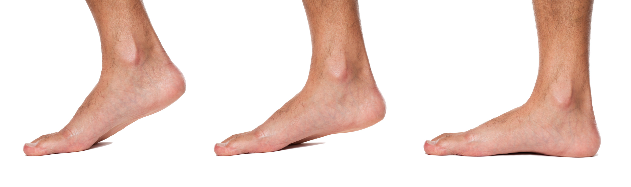 Fisioterapia en las alteraciones ortopédicas del pie - San Sebastián de los  Reyes