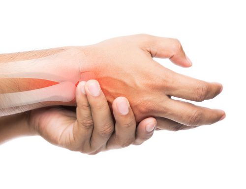 Tratamiento de fisioterapia para las fracturas de la mano