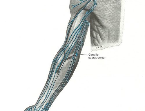 Linfedema o linfoedema – ¿qué es? y ¿cómo se trata?