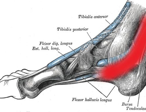 Síndrome del túnel del tarso – tratamiento de fisioterapia