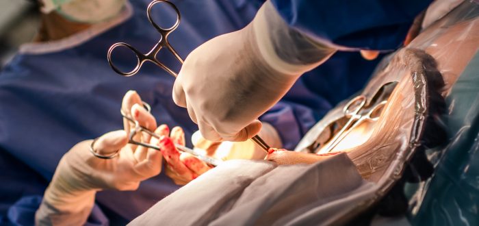 operación de cesarea