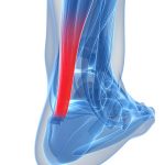 ¿Qué funciones tienen los tendones? ¿cómo se lesionan?