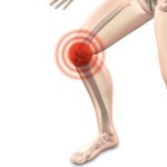 Artrosis de rodilla, ¿y ahora qué?