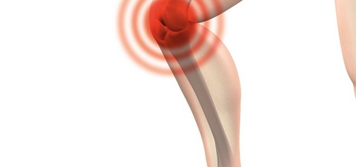 artrosis-rodilla