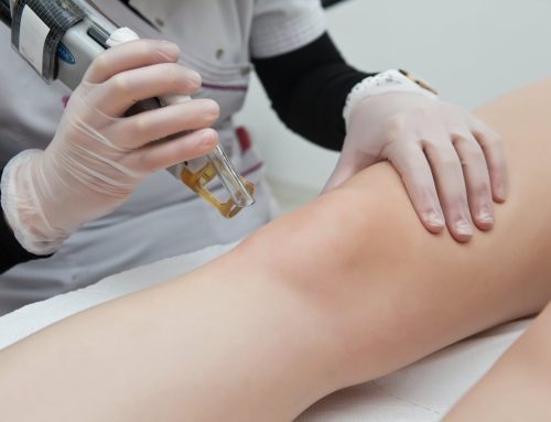 Prótesis de rodilla, ¿cómo puede ayudarte la fisioterapia domiciliaria?